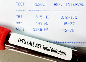肝機能障害の数値の見方と判断基準