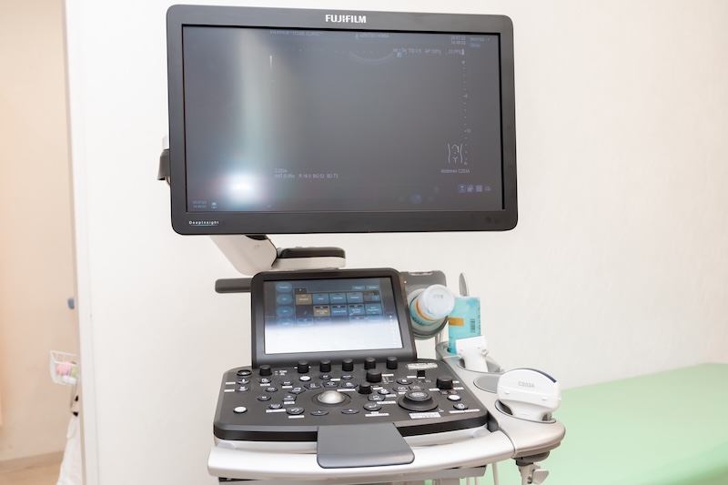 超音波(エコー)診断装置